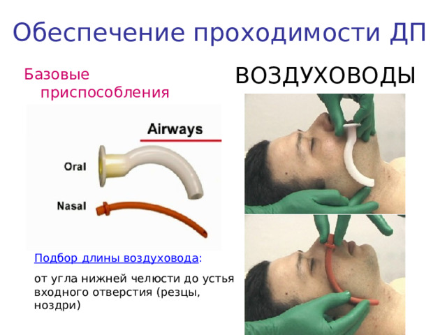 Обеспечение проходимости ДП ВОЗДУХОВОДЫ Базовые приспособления Подбор длины воздуховода : от угла нижней челюсти до устья входного отверстия (резцы, ноздри)