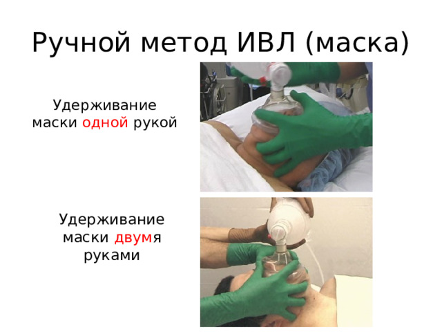 Ручной метод ИВЛ (маска)  Удерживание маски одной рукой  Удерживание маски двум я руками