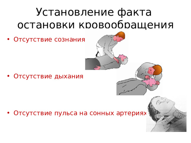 Установление факта  остановки кровообращения Отсутствие сознания Отсутствие дыхания Отсутствие пульса на сонных артериях