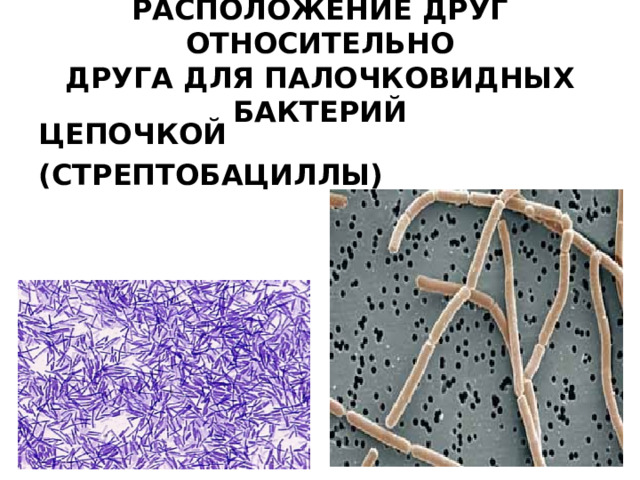 РАСПОЛОЖЕНИЕ ДРУГ ОТНОСИТЕЛЬНО  ДРУГА ДЛЯ ПАЛОЧКОВИДНЫХ БАКТЕРИЙ ЦЕПОЧКОЙ (СТРЕПТОБАЦИЛЛЫ)