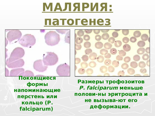 МАЛЯРИЯ: патогенез Покоящиеся формы напоминающие перстень или кольцо (Р. falciparum)  Размеры трофозоитов  Р. falciparum меньше полови-ны эритроцита и не вызыва-ют его деформации.