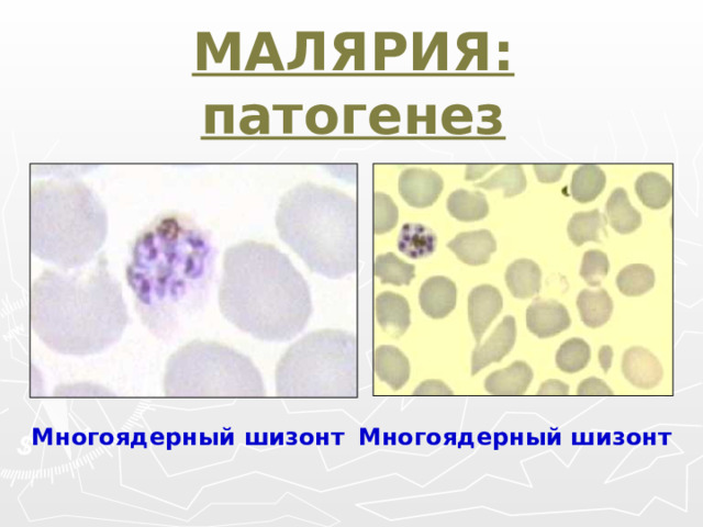 МАЛЯРИЯ: патогенез Многоядерный шизонт  Многоядерный шизонт