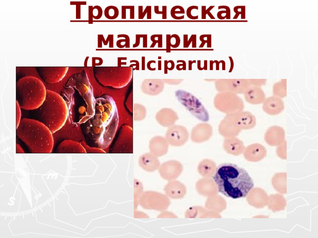 Тропическая малярия   ( P. Falciparum)
