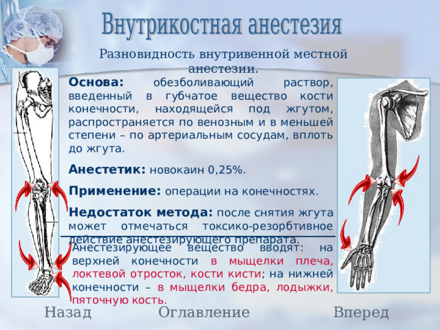 Разновидность внутривенной местной анестезии. Основа: обезболивающий раствор, введенный в губчатое вещество кости конечности, находящейся под жгутом, распространяется по венозным и в меньшей степени – по артериальным сосудам, вплоть до жгута. Анестетик: новокаин 0,25%. Применение: операции на конечностях. Недостаток метода: после снятия жгута может отмечаться токсико-резорбтивное действие анестезирующего препарата. Анестезирующее вещество вводят: на верхней конечности в мыщелки плеча, локтевой отросток, кости кисти ; на нижней конечности – в мыщелки бедра, лодыжки, пяточную кость. Назад Вперед Оглавление 21