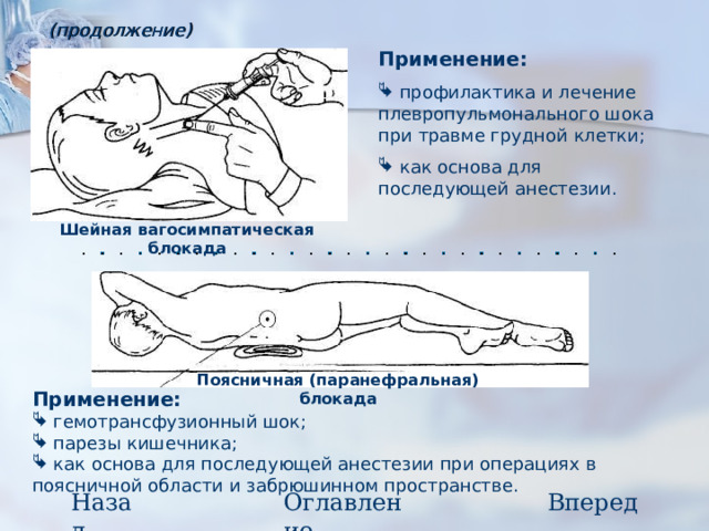 (продолжение) Применение:   профилактика и лечение плевропульмонального шока при травме грудной клетки;  как основа для последующей анестезии. Шейная вагосимпатическая блокада Поясничная (паранефральная) блокада Применение:   гемотрансфузионный шок;  парезы кишечника;  как основа для последующей анестезии при операциях в поясничной области и забрюшинном пространстве. Назад Оглавление Вперед