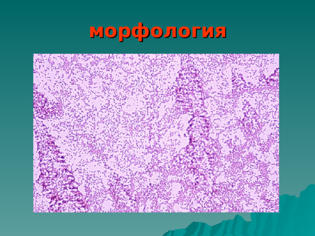 морфология