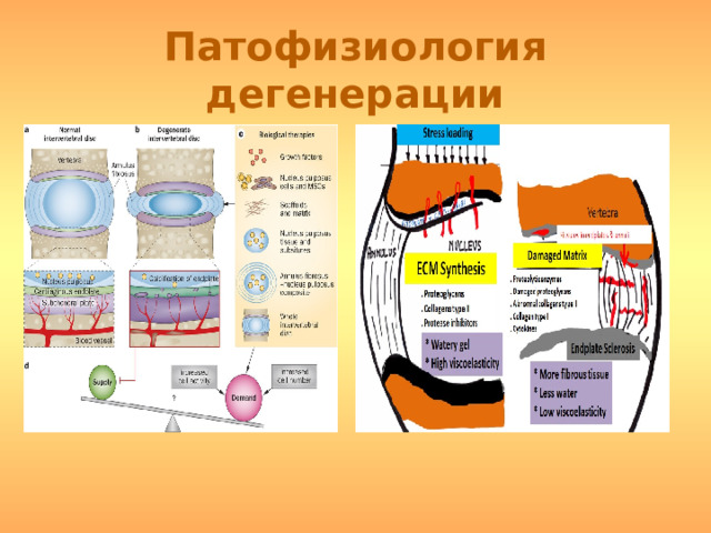 Патофизиология дегенерации