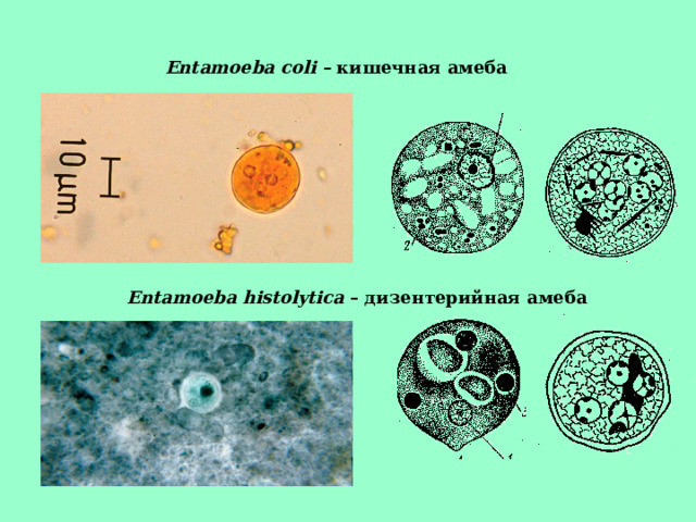 Entamoeba coli – кишечная амеба Entamoeba histolytica – дизентерийная амеба