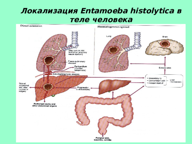 Локализация Entamoeba histolytica в теле человека