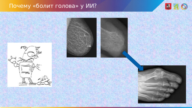 Почему «болит голова» у ИИ?