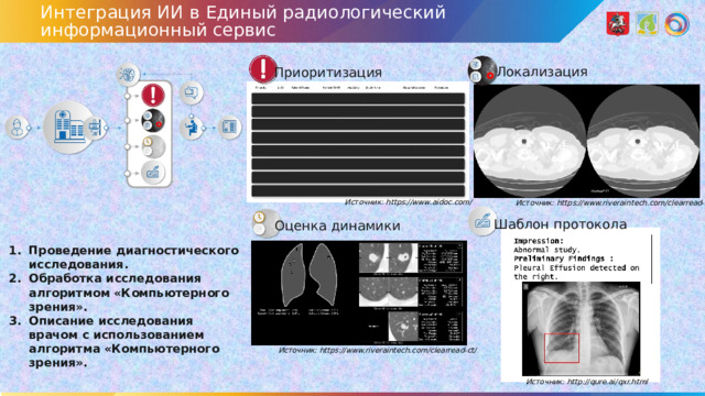 Интеграция ИИ в Единый радиологический информационный сервис Локализация Приоритизация Источник: https://www.aidoc.com/ Источник: https://www.riveraintech.com/clearread-ct/ Шаблон протокола Оценка динамики Проведение диагностического исследования. Обработка исследования алгоритмом «Компьютерного зрения». Описание исследования врачом с использованием алгоритма «Компьютерного зрения». Источник: https://www.riveraintech.com/clearread-ct/ Источник: http://qure.ai/qxr.html