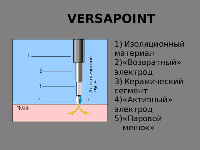 VERSAPOINT Изоляционный материал « Возвратный » электрод Керамический сегмент « Активный » электрод