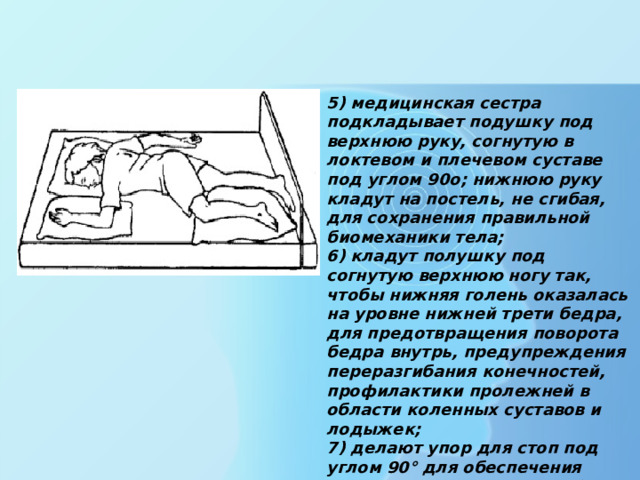 5) медицинская сестра подкладывает подушку под верхнюю руку, согнутую в локтевом и плечевом суставе под углом 90о; нижнюю руку кладут на постель, не сгибая, для сохранения правильной биомеханики тела; 6) кладут полушку под согнутую верхнюю ногу так, чтобы нижняя голень оказалась на уровне нижней трети бедра, для предотвращения поворота бедра внутрь, предупреждения переразгибания конечностей, профилактики пролежней в области коленных суставов и лодыжек; 7) делают упор для стоп под углом 90° для обеспечения правильного тыльного сгибания стоп и предотвращения их «провисания».