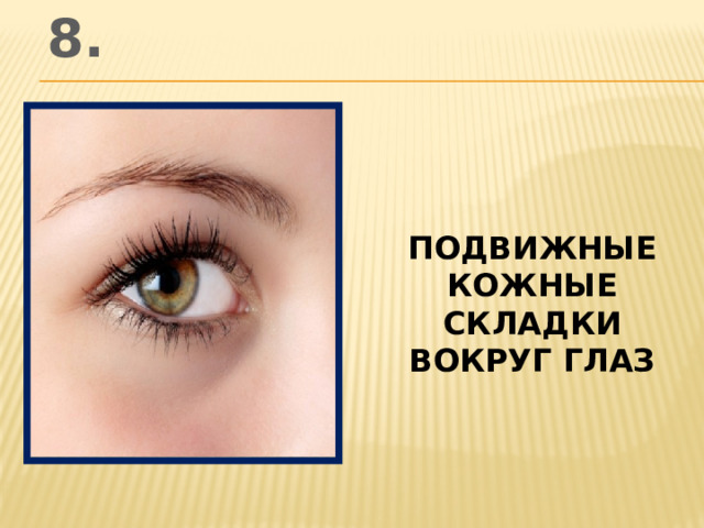 8. подвижные кожные складки вокруг глаз
