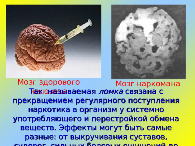 Мозг здорового человека Мозг наркомана Так называемая ломка связана с прекращением регулярного поступления наркотика в организм у системно употребляющего и перестройкой обмена веществ. Эффекты могут быть самые разные: от выкручивания суставов, судорог, сильных болевых ощущений до легкого дискомфорта или чувства жара.