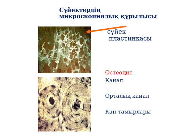 Сүйектердің микроскопиялық құрылысы  сүйек пластинкасы Остеоцит Канал Орталық канал Қан тамырлары