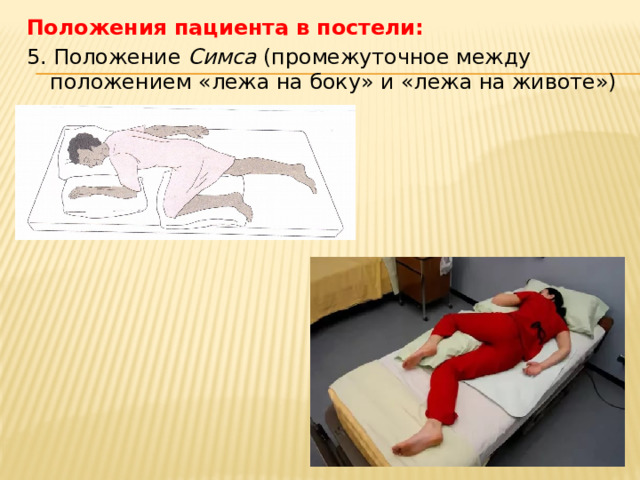 Положения пациента в постели: 5. Положение Симса (промежуточное между положением «лежа на боку» и «лежа на животе»)