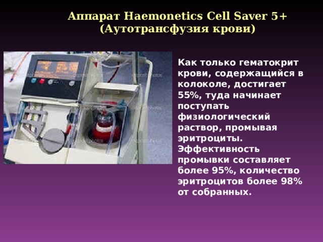 Аппарат Haemonetics Cell Saver 5+ ( Аутотрансфузия крови) Как только гематокрит крови, содержащийся в колоколе, достигает 55%, туда начинает поступать физиологический раствор, промывая эритроциты. Эффективность промывки составляет более 95%, количество эритроцитов более 98% от собранных.
