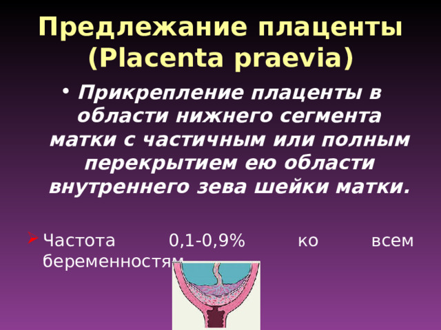 Предлежание плаценты  ( Placenta praevia )