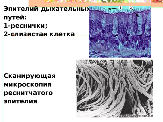 Эпителий дыхательных путей: 1-реснички; 2-слизистая клетка      Сканирующая микроскопия реснитчатого эпителия