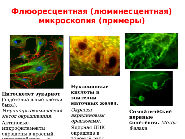 Флюоресцентная (люминесцентная) микроскопия (примеры) . . . . Нуклеиновые кислоты в эпителии маточных желез. Окраска акридиновым оранжевым . Ядерная ДНК окрашена в зеленый цвет,  РНК – в красный. Цитоскелет эукариот (эндотелиальные клетки быка). Имунноцитохимический метод окрашивания . Актиновые микрофиламенты окрашены в красный, микротрубочки — в зеленый, ядра клеток — в голубой цвет. Симпатические нервные сплетения. Метод Фалька