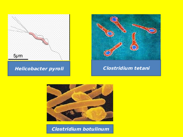 Clostridium tetani Helicobacter pyroli Clostridium botulinum