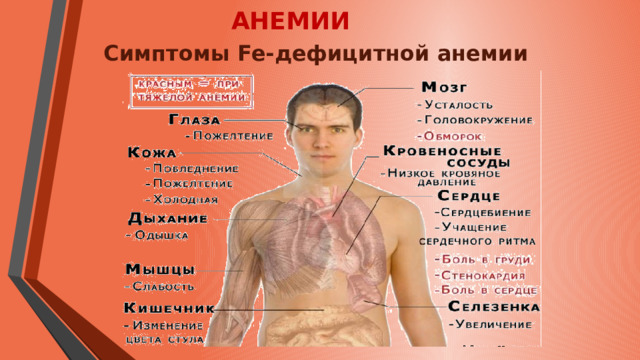 АНЕМИИ Симптомы Fe-дефицитной анемии