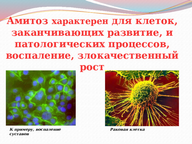 Амитоз характерен для клеток, заканчивающих развитие, и патологических процессов, воспаление, злокачественный рост К примеру, воспаление суставов Раковая клетка