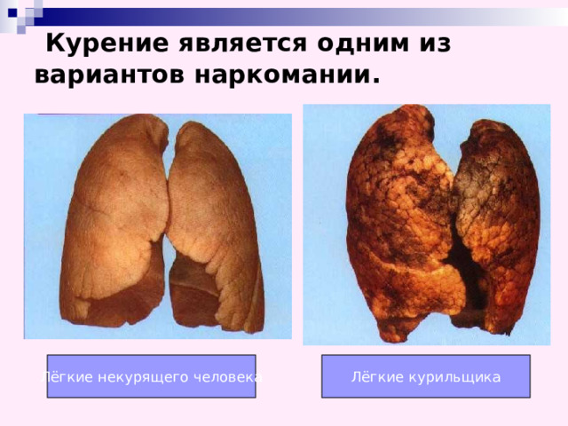 Курение является одним из вариантов наркомании.    Лёгкие некурящего человека Лёгкие курильщика