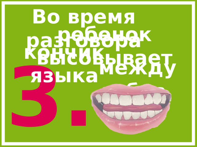 Во время разговора ребенок высовывает кончик языка 3. между зубов.