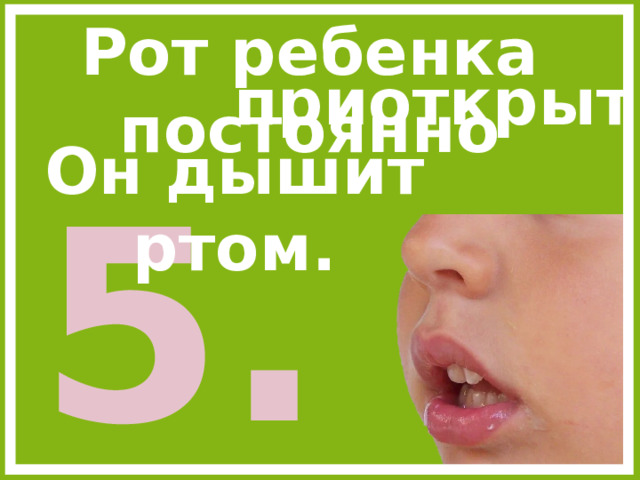 Рот ребенка постоянно приоткрыт. Он дышит ртом. 5.