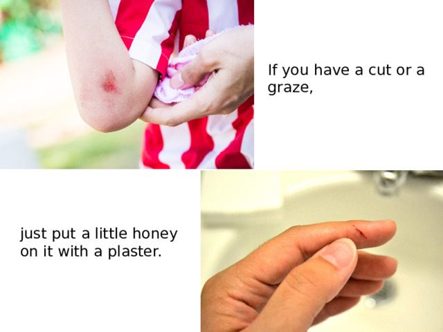 If you have a cut or a graze, just put a little honey on it with a plaster.