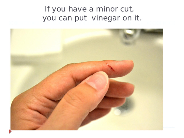 If you have a minor cut,  you can put vinegar on it.