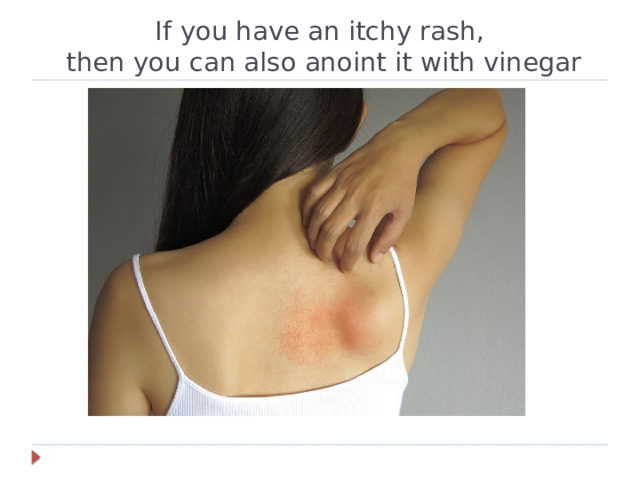 If you have an itchy rash,  then you can also anoint it with vinegar