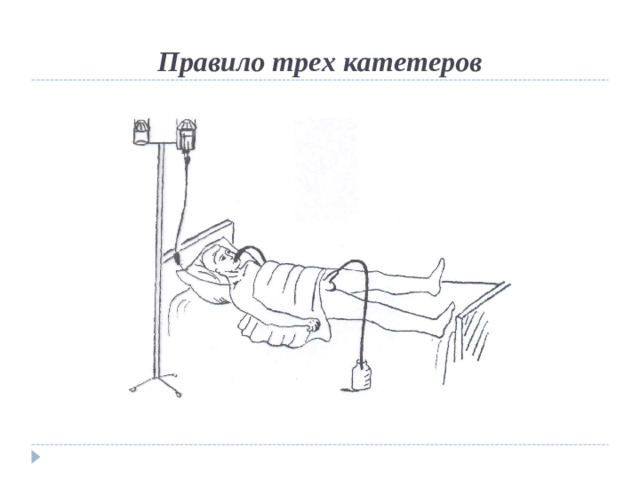 Правило трех катетеров