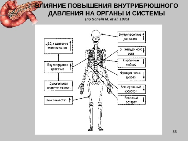 ВЛИЯНИЕ ПОВЫШЕНИЯ ВНУТРИБРЮШНОГО ДАВЛЕНИЯ НА ОРГАНЫ И СИСТЕМЫ  ( по Schein M . et al . 1995)