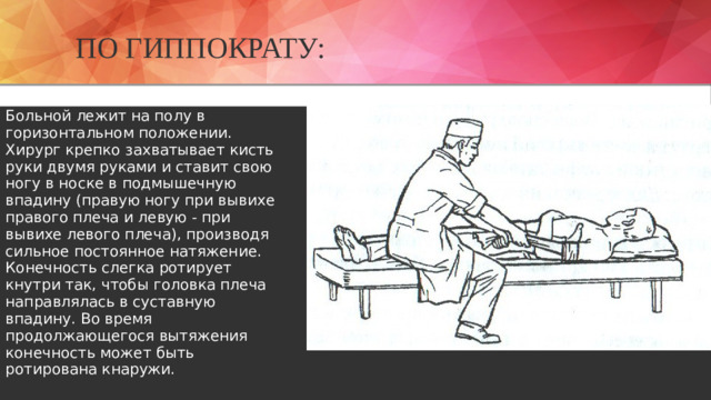 По Гиппократу: Больной лежит на полу в горизонтальном положении. Хирург крепко захватывает кисть руки двумя руками и ставит свою ногу в носке в подмышечную впадину (правую ногу при вывихе правого плеча и левую - при вывихе левого плеча), производя сильное постоянное натяжение. Конечность слегка ротирует кнутри так, чтобы головка плеча направлялась в суставную впадину. Во время продолжающегося вытяжения конечность может быть ротирована кнаружи.