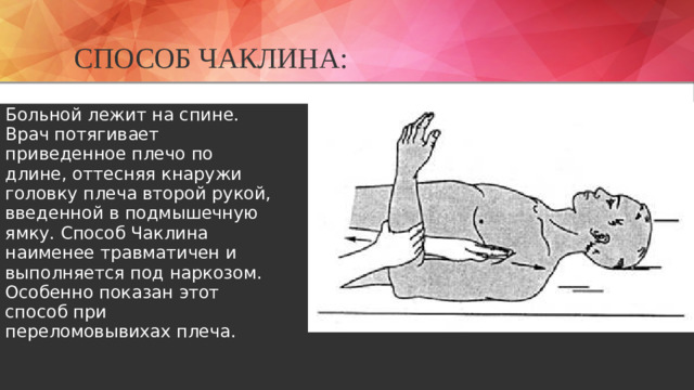 Способ Чаклина: Больной лежит на спине. Врач по­тягивает приведенное плечо по длине, оттесняя кнаружи головку плеча второй рукой, введенной в подмышечную ямку. Способ Чаклина наименее травматичен и выполняется под наркозом. Особенно показан этот способ при переломовывихах плеча.