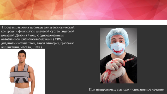 После вправления проводят рентгенологический контроль и фиксируют плечевой сустав гипсовой повязкой Дезо на 4 нед. с одновременным назначением физиомеханотерапии (УВЧ, диадинамические токи, затем озокерит, грязевые аппликации, массаж, ЛФК). При невправимых вывихах - оперативное лечение.