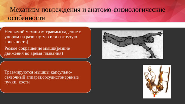 Механизм повреждения и анатомо-физиологические особенности Непрямой механизм травмы(падение с упором на разогнутую или согнутую конечность) Резкое сокращение мышц(резкие движения во время плавания) Травмируются мышцы,капсульно-связочный аппарат,сосудистонервные пучки, кости