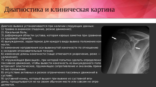 Диагностика и клиническая картина Диагноз вывиха устанавливается при наличии следующих данных: 1) травма в анамнезе (падение, резкое движение); 2) Локальная боль; 3) деформация области сустава, которая хорошо заметна при сравнении со здоровой стороной; 4) вынужденное, характерное для каждого вида вывиха положение конеч- ности; 5) изменение направления оси вывихнутой конечности по отношению к соседним опознавательным точкам; 6) изменение длины конечности (чаще отмечается укорочение, реже — удлинение); 7) «пружинящая фиксация», при которой попытка сделать определенное пассивное движение, чтобы вывести конечность из вынужденного положения, встречает эластическое, пружинящее сопротивление и она вновь принимает то же положение; 8) отсутствие активных и резкое ограничение пассивных движений в суставе; 9) суставной конец, который вышел при вывихе из суставной впа- дины, прощупывается не на своем обычном месте или совсем не опре- деляется.