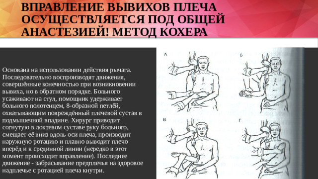Вправление Вывихов плеча осуществляется под общей анастезией! Метод Кохера   Основана на использовании действия рычага. Последовательно воспроизводят движения, совершённые конечностью при возникновении вывиха, но в обратном порядке. Больного усаживают на стул, помощник удерживает больного полотенцем, 8-образной петлёй, охватывающим повреждённый плечевой сустав в подмышечной впадине. Хирург приводит согнутую в локтевом суставе руку больного, смещает её вниз вдоль оси плеча, производит наружную ротацию и плавно выводит плечо вперёд и к срединной линии (нередко в этот момент происходит вправление). Последнее движение - забрасывание предплечья на здоровое надплечье с ротацией плеча кнутри.