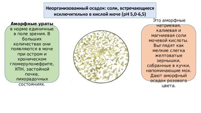 Это аморфные натриевая, калиевая и магниевая соли мочевой кислоты. Выглядят как мелкие слегка желтоватые зернышки, собранные в кучки, напоминающие мох. Дают аморфный осадок розового цвета. Аморфные ураты в норме единичные в поле зрения. В больших количествах они появляются в моче при остром и хроническом гломерулонефрите, ХПН, застойной почке, лихорадочных состояниях.