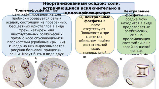 Неорганизованный осадок: соли, встречающиеся исключительно в щелочной моче Трипельфосфаты, нейтральные фосфаты в норме отсутствуют. Появляются при циститах, обильном приёме растительной пищи, минеральной воды, рвоте. Трипельфосфаты . При центрифугировании на дне пробирки образуется белый осадок, состоящий из прозрачных, бесцветных кристаллов в виде трех-, четырех- или шестиугольных ромбических призм с косо спускающимися плоскостями (гробовые крышки). Иногда на них вырисовывается рисунок бельевой прищепки, санки. Могут быть в виде двух скрещенных под углом листьев папоротника. Нейтральные фосфаты . В осадке мочи находится в виде продолговатых ромбических, сильно преломляющих свет табличек с косой концевой гранью, трапеций. Не образуют розеток.