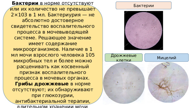 Бактерии Бактерии в норме отсутствуют или их количество не превышает 2×103 в 1 мл. Бактериурия — не абсолютно достоверное свидетельство воспалительного процесса в мочевыводящей системе. Решающее значение имеет содержание микроорганизмов. Наличие в 1 мл мочи взрослого человека 105 микробных тел и более можно расценивать как косвенный признак воспалительного процесса в мочевых органах. Грибы дрожжевые в норме отсутствуют; их обнаруживают при глюкозурии, антибактериальной терапии, длительном хранении мочи . Дрожжевые клетки Мицелий