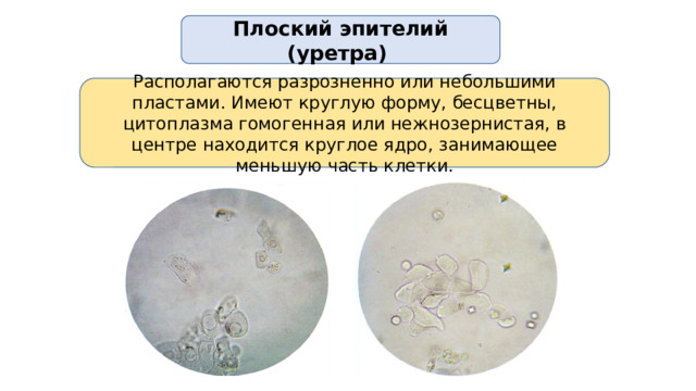 Плоский эпителий (уретра) Располагаются разрозненно или небольшими пластами. Имеют круглую форму, бесцветны, цитоплазма гомогенная или нежнозернистая, в центре находится круглое ядро, занимающее меньшую часть клетки.