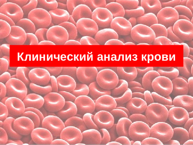 Клинический анализ крови Хиггинс К.    Расшифровка клинических лабораторных анализов / К. Хиггинс; пер. с англ.; под ред. проф. В. Л. Эмануэля. — 3-е изд., испр. — М. : БИНОМ. Лаборатория знаний, 2008. — 376 с. ил Клиническое руководство по лабораторным тестам / под ред. Н.У. Тица. – М.:«Юнимед-пресс», 2003. - c.   2. Карманный справочник по диагностическим тестам / Под ред. Камышникова В.С. - М.:МЕДпресс-информ, 2004.- 464 с.   3. Клинические лабораторные тесты от А до Я и их диагностические профили / Камышникова В.С. - М.:МЕДпресс-информ, 2007.- 320 с.