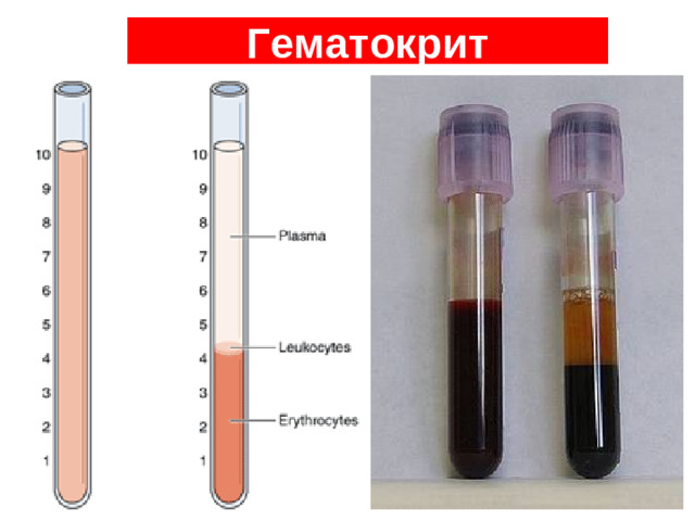 Эритропоэз