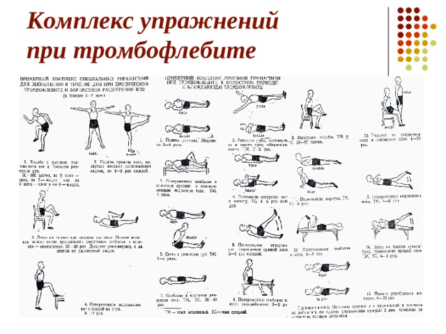 Комплекс упражнений при тромбофлебите