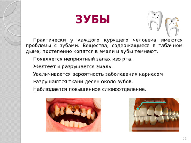ЗУБЫ Практически у каждого курящего человека имеются проблемы с зубами. Вещества, содержащиеся в табачном дыме, постепенно копятся в эмали и зубы темнеют. Появляется неприятный запах изо рта. Желтеет и разрушается эмаль. Увеличивается вероятность заболевания кариесом. Разрушаются ткани десен около зубов. Наблюдается повышенное слюноотделение.